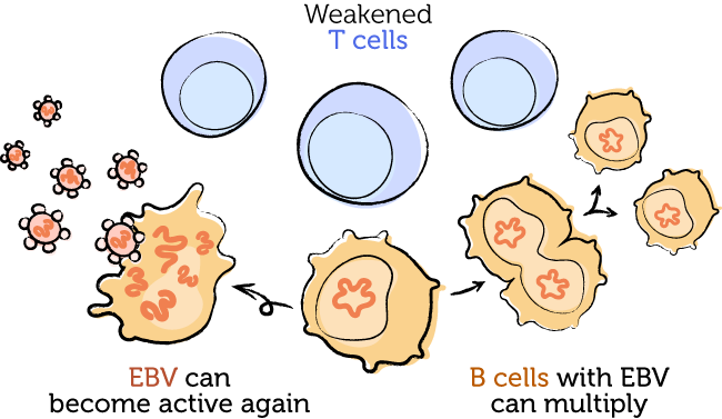 Drawing of weakened T cells that are less able to keep EBV-infected B cells under control.