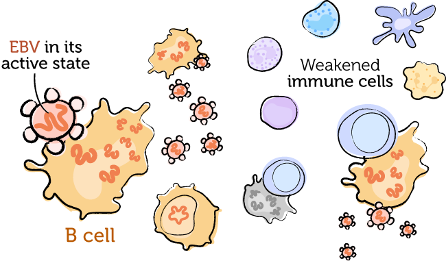 Drawing of the weakened immune system having a harder time fighting a first-time EBV infection.